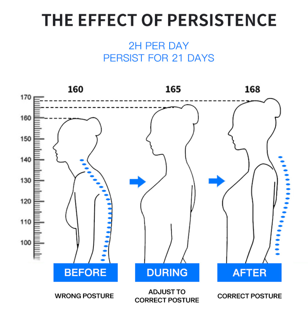 AlignBack Straightaway: Posture Perfector